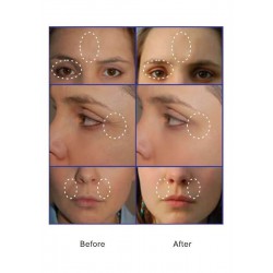 Face Treatments (99)